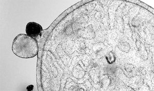 Optimizing the Cell and Gene Therapy Patient Journey Through Integrated CRO/CDMO Partnership