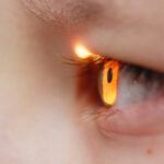 Ophthalmology-clinical-trials