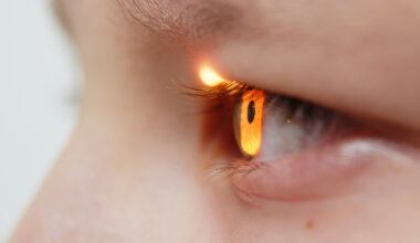 Ophthalmology-clinical-trials