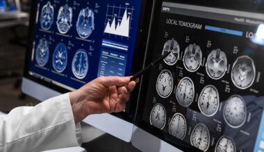 clario-alzheimers-aria-assessment